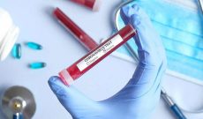 رنگ‌بندی کرونایی صدای علوم‌پزشکی آبادان را هم درآورد