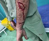 محیط بان شوشتری در درگیری با شکارچیان متخلف مجروح شد